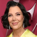 Kris Jenner Face Lift